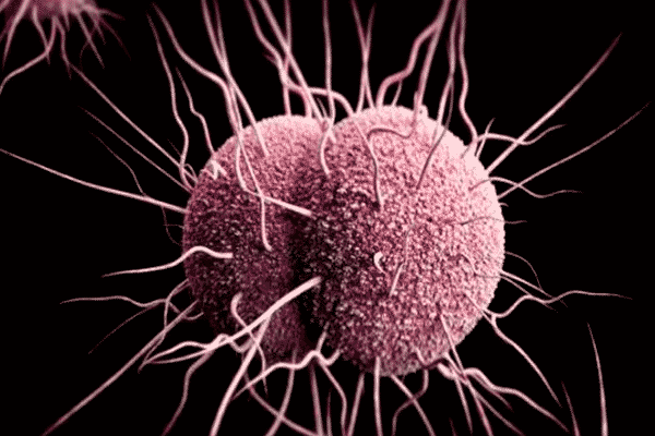 Infecciones de transmisión sexual síntomas