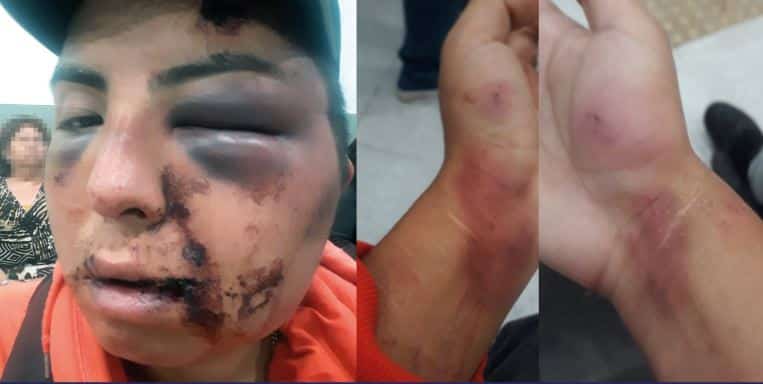 ataque homofóbico hermana 1