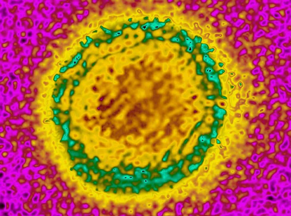 dengue transmisión sexual 1