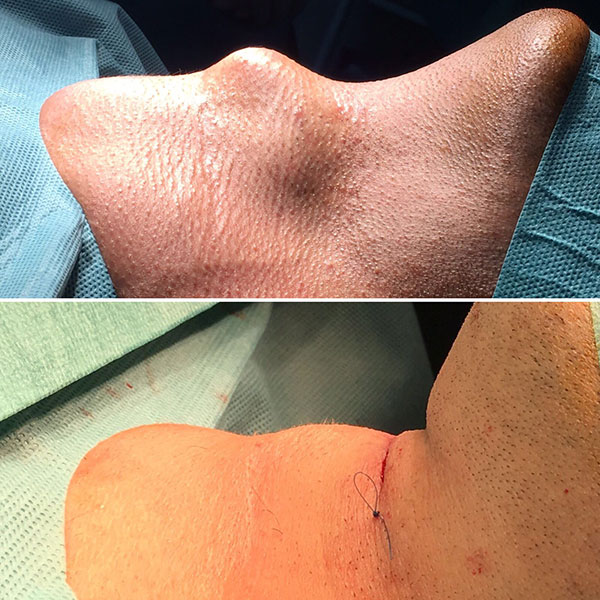 feminización de la voz 1