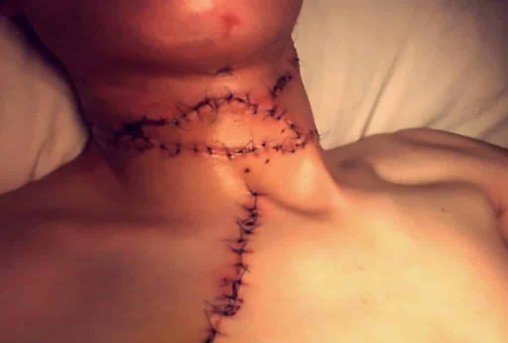 padre-cortó-garganta-hijo-gay