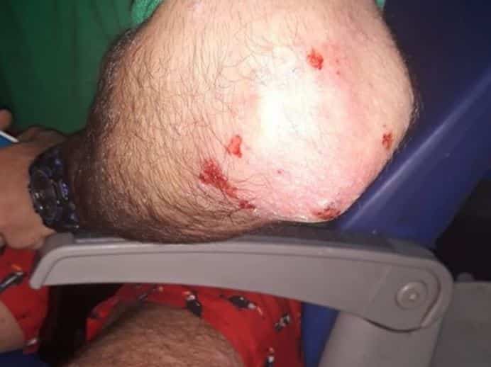 latigazos pareja gay 1