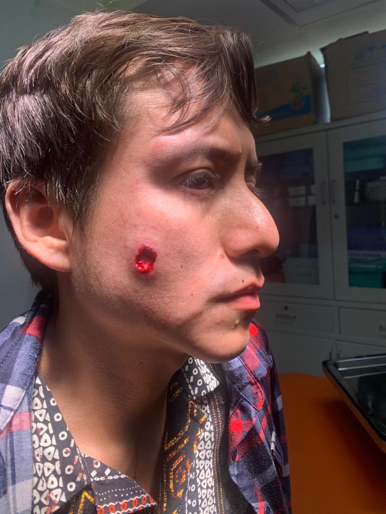 policía joven gay atacado