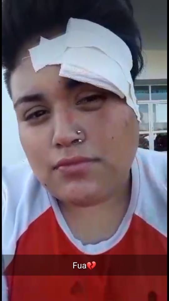 lesbiana golpean hombres