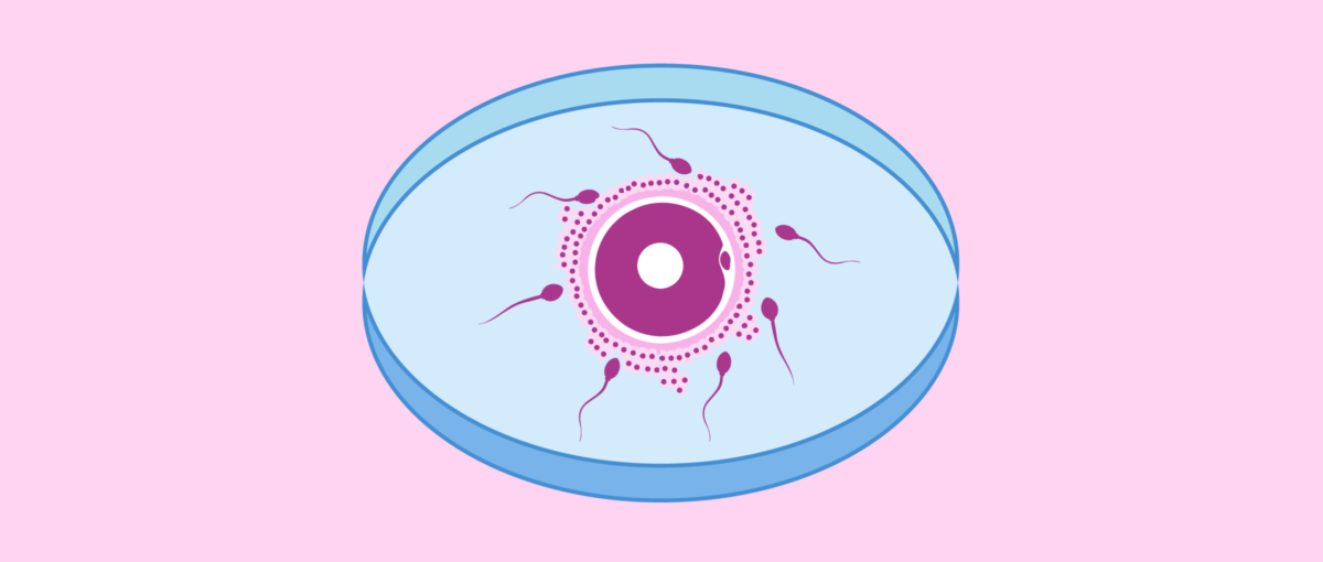 fecundación in vitro