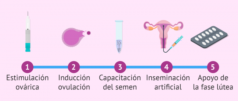 formas tener hijos lesbiana