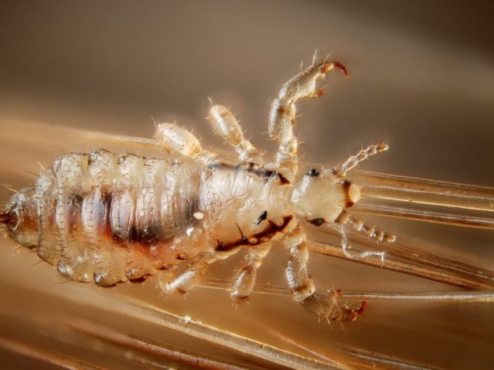 ladillas síntomas piojos púbicos