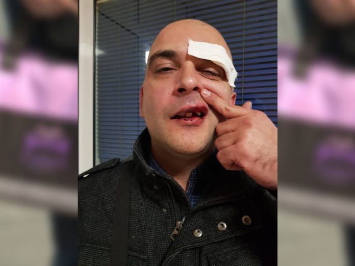 ataque bolsa rosa 3 Ilija Vucevic