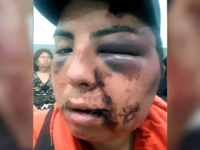 ataque homofóbico hermana 4