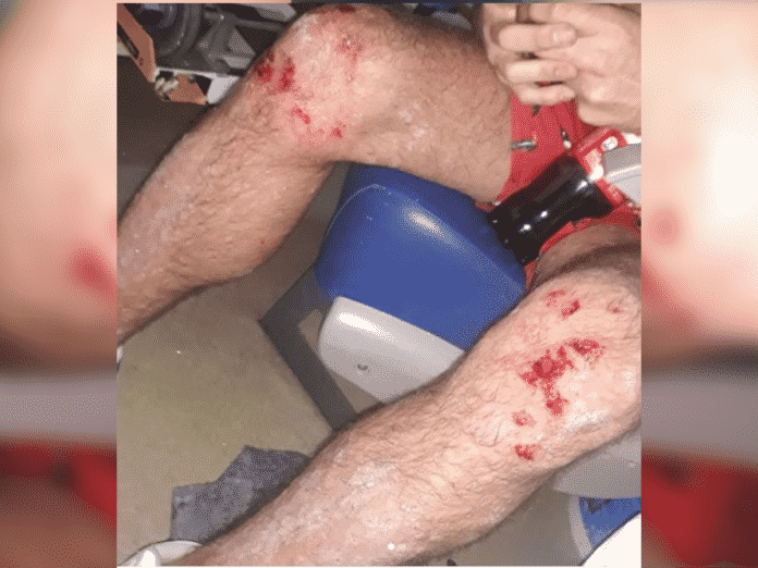 latigazos pareja gay 4