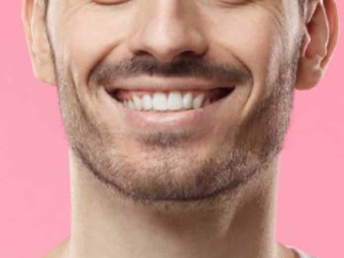 tips sonrisa radiante