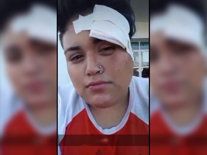 lesbiana golpean hombres lesbiana golpean hombres