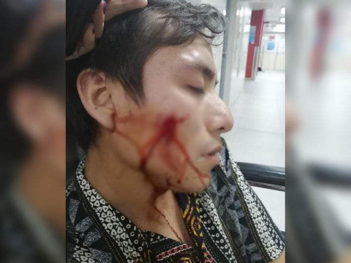 policía joven gay atacado