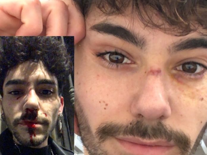 golpearon hetero parecer gay