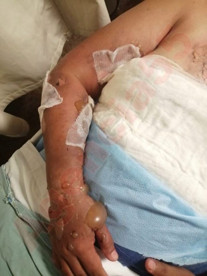 policía-mujer-lesbiana-queman-chiapas-