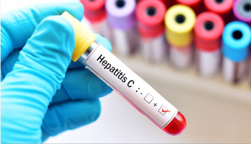 casos-hepatitis-c-hombres-gays-bisexuales