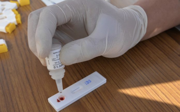 muertos-vih-prueba-vih-mexico-covid-19 muertos-vih-prueba-vih-mexico-covid-19