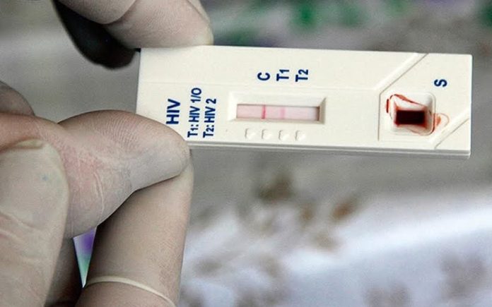 aumento-casos-vih-pandemia-COVID-19