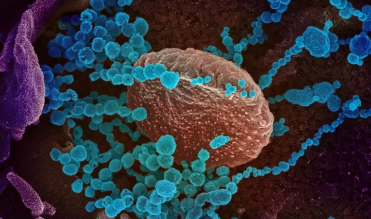 vih-mayor-riesgo-covid-19-semen