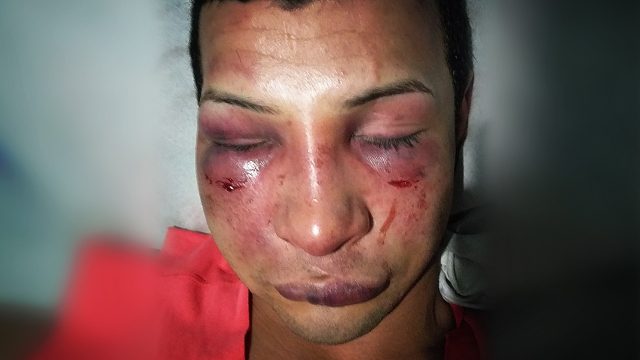 mes-orgullo-golpiza-joven-gay-venezuela