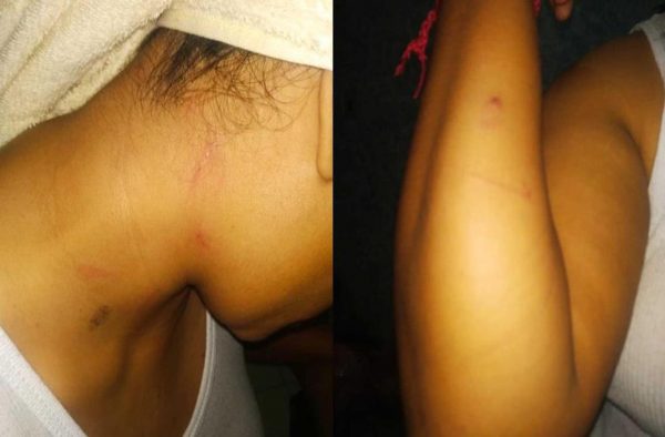 golpiza pareja lésbica