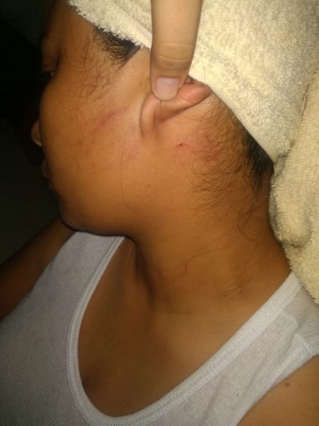 golpiza pareja lésbica