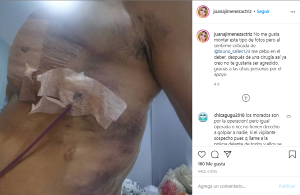 Agresión Juana Jiménez