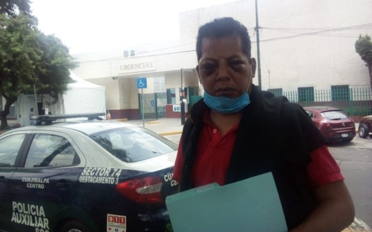 El imitador de Juan Gabriel Oscar Maldonado sufrió un ataque homofóbico durante un show