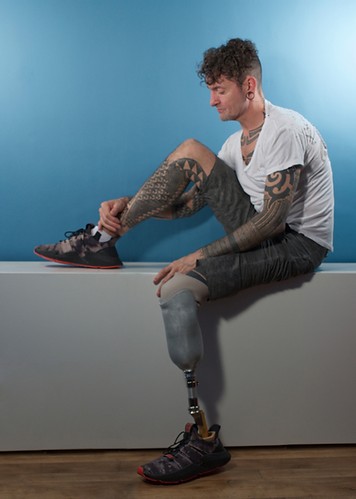 hombre gay sin una pierna pole dance