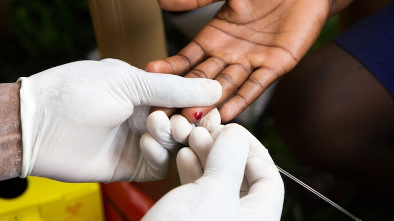 Reportan aumento de ITS en hombres gay durante pandemia