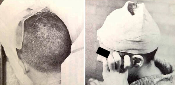 terapia de conversión