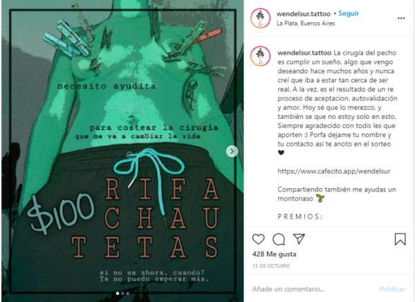 Cirugía trans Wen Vera