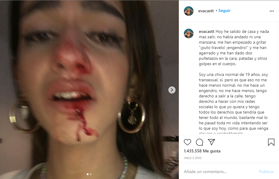 Ataque transfóbico Eva Vildosola