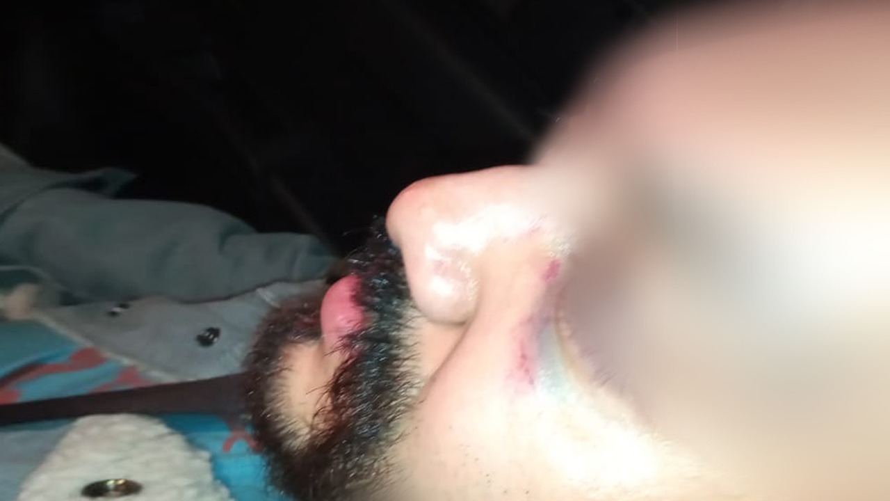 Paciente con VIH fue golpeado por doctor del ISSSTE