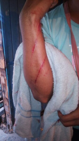 Ataque machete chica trans