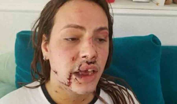 Mía Retacco intento homicidio