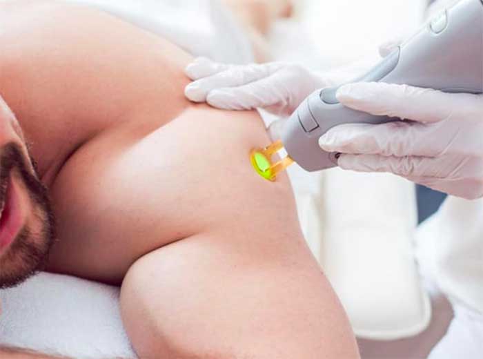 depiladora crema laser metodo