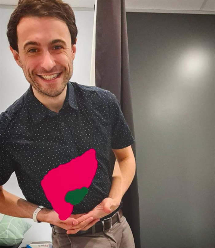 Día Mundial hepatitis ITS