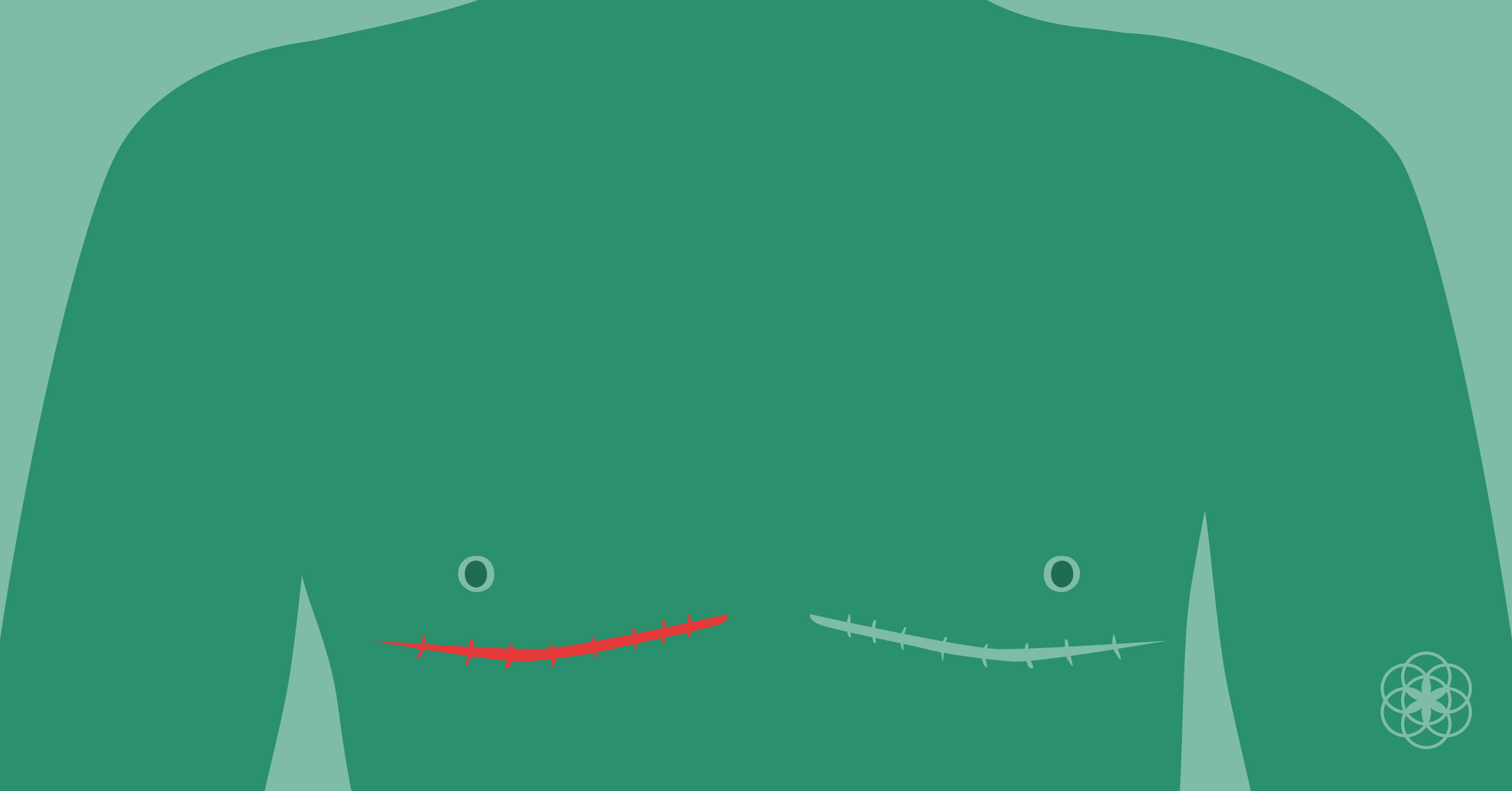 mastectomía hombres trans