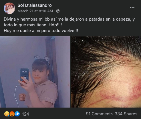 Sol D'alessandro azul adolescente trans Argentina