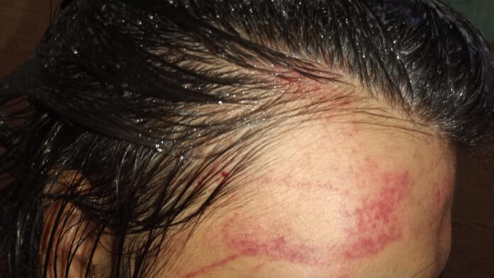 azul-adolescente-trans-argentina-ataque azul adolescente trans argentina ataque