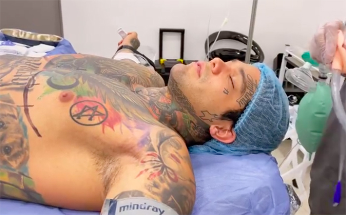 cirugía implantes senos