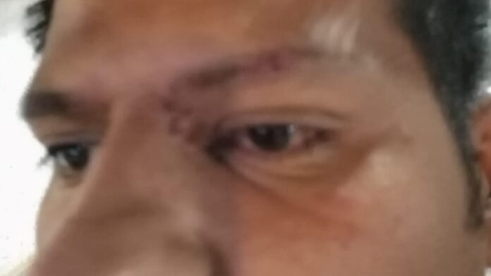 Pareja gay sufre agresión en Metro de CDMX