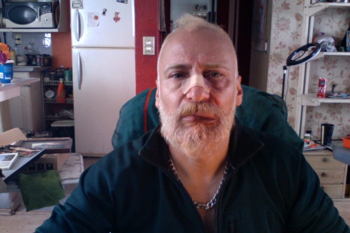 Daniel Cobian muestra lesiones