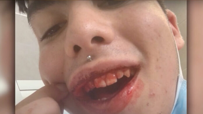 joven paliza mamá padrastro por ser gay