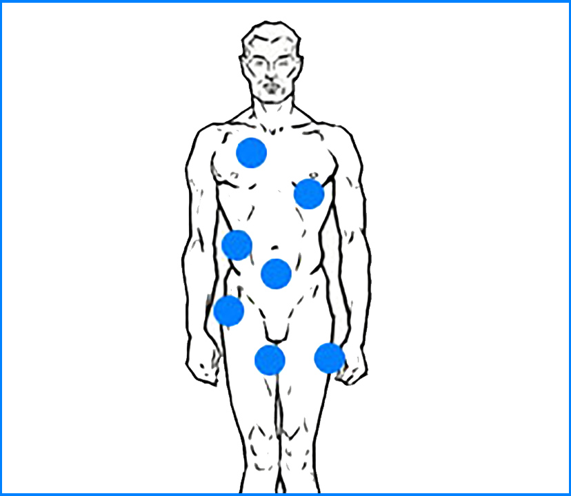 Cirugías masculinización de torso