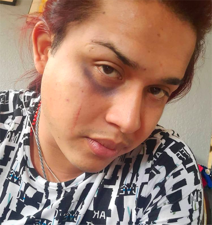 Jessy ventura heridas conductor uber gay