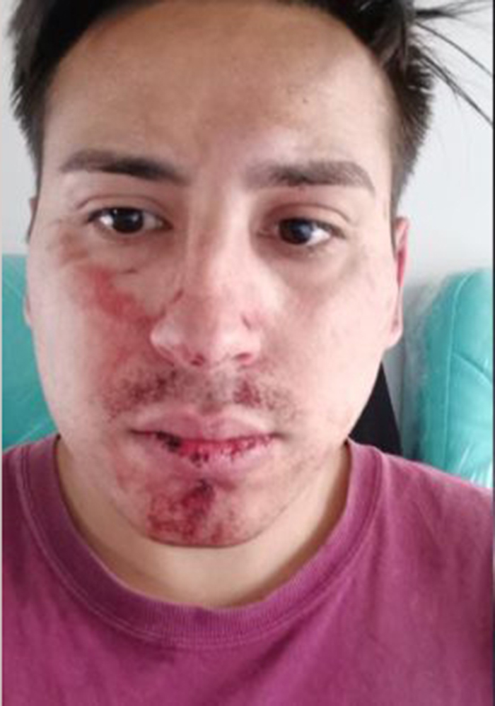 pareja gay golpes chile