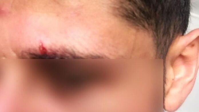 Ataque homofóbico en Playa del Carmen Quintana Roo