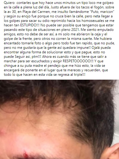 Ataque homofóbico a Cristhian Vasa